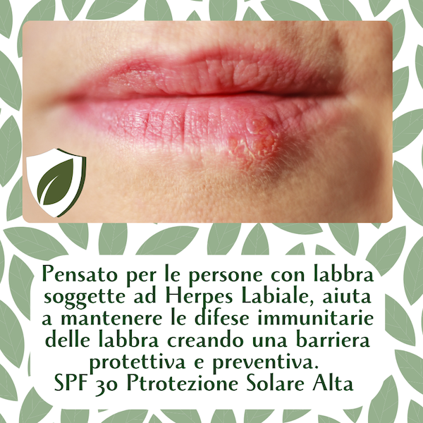 Balsamo Labbra Difesa Naturale